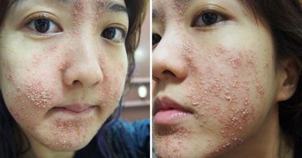 Tác hại của kem trộn không rõ nguồn gốc xuất xứ