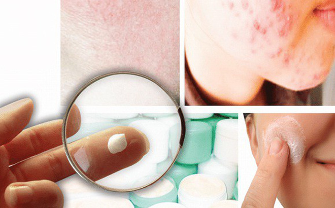 Những nguy hiểm tiềm tàng từ kem trộn không rõ nguồn gốc xuất xứ